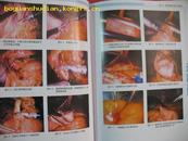 腹腔镜外科手术彩色图谱 CD-1472