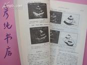 日文原版医学期刊 呼吸系统与循环系统《呼吸と循环》82年印 第30卷 第2号漏斗胸 人工血液 等内容~