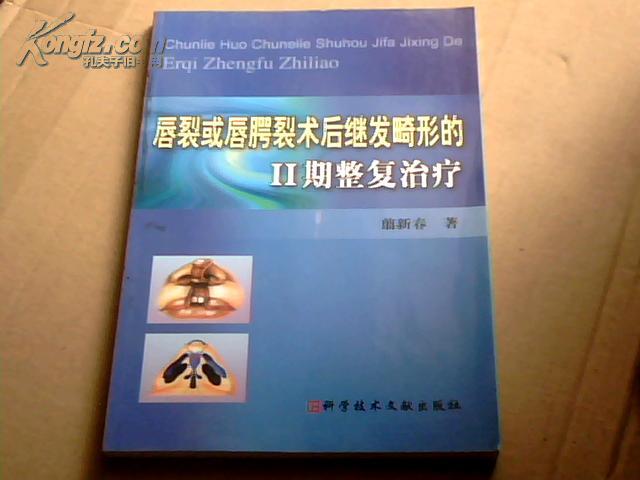 唇裂或唇腭裂术后继发畸形的2期整复治疗