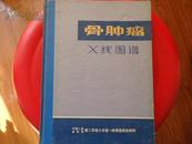 骨肿瘤X线图谱  （第三军医大学附属西南医院骨科创始人吴先道印章，带毛主席语录，大16开硬精装80余种骨病，558幅骨X线图片）★【本书摊主营老版本中医药书籍】