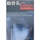 股骨头缺血性坏死的修复与再造（第2版）主编：赵德伟 人民卫生出版社 ISBN：9787117094795