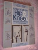 《髋关节和膝关节炎》 英文原版插图本 Arthritis of the Hip & Knee: The Active Person's Guide to Taking Charge