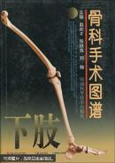 骨科手术图谱.下肢