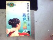 女性病按摩疗法彩色图解