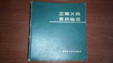 正常X线变异图谱  一版一印2800册（包邮，一天内发货）