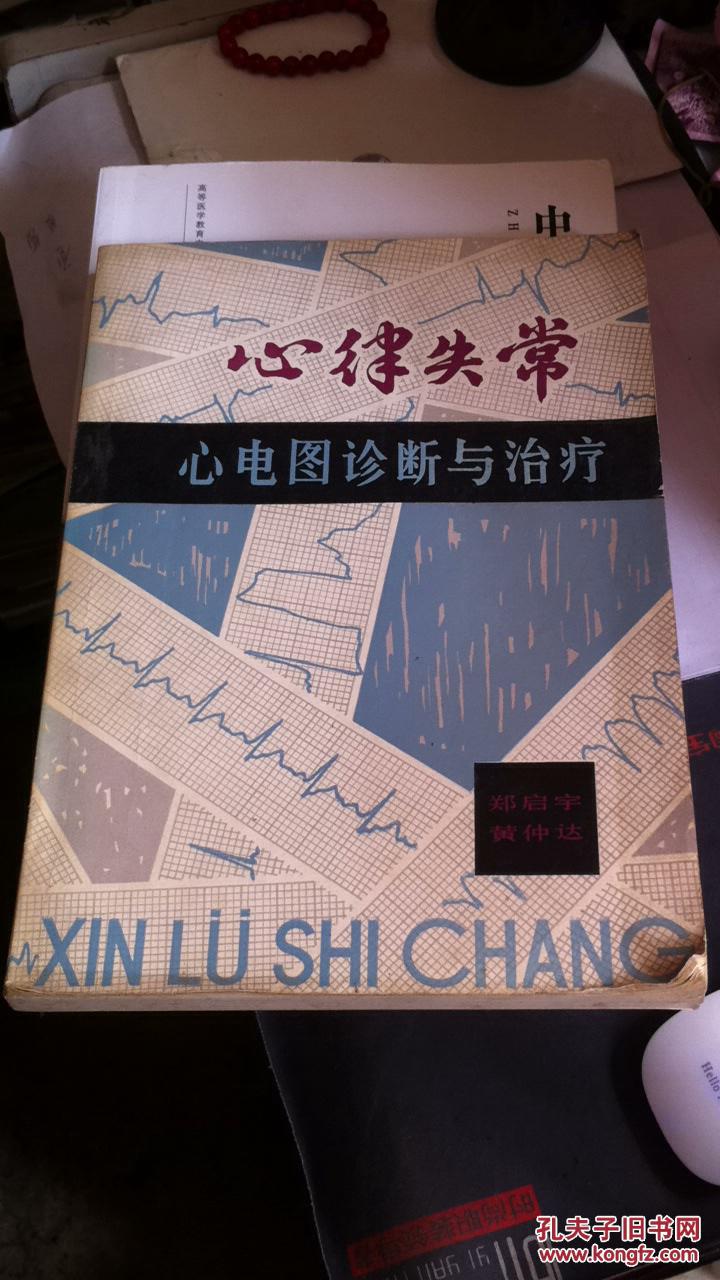 心律失常：心电图诊断与治疗