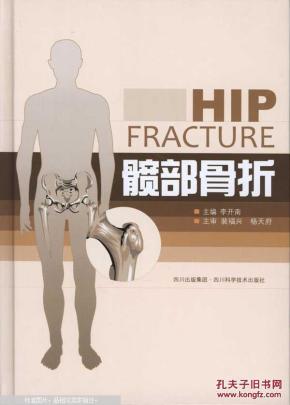 髋部骨折