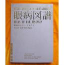 眼病图谱（大16开 全彩图片581幅， 安徽医学院眼科老专家李同济编著