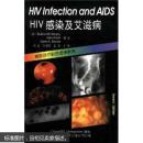 HIV感染及艾滋病