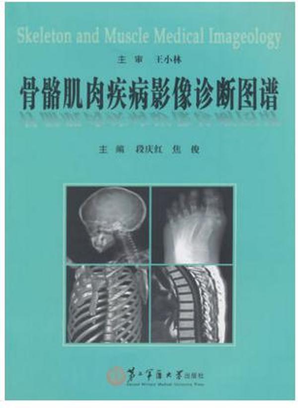 骨骼肌肉疾病影像诊断图谱