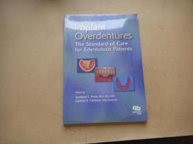 Implant Overdentures: The Standard of Care for Edentulous Patients〔外文原版〕