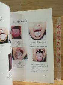 望舌识病的奥秘