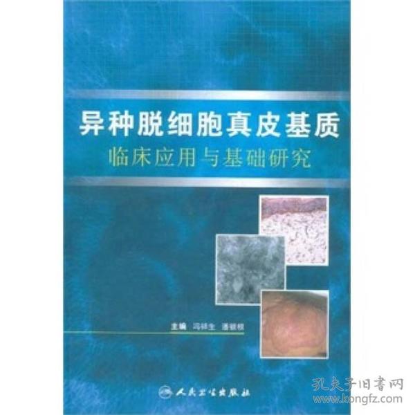 异种脱细胞真皮基质临床应用与基础研究