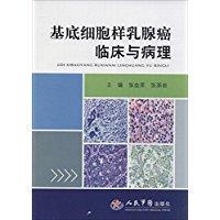 基底细胞样乳腺癌临床与病理