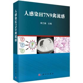 人感染H7N9禽流感