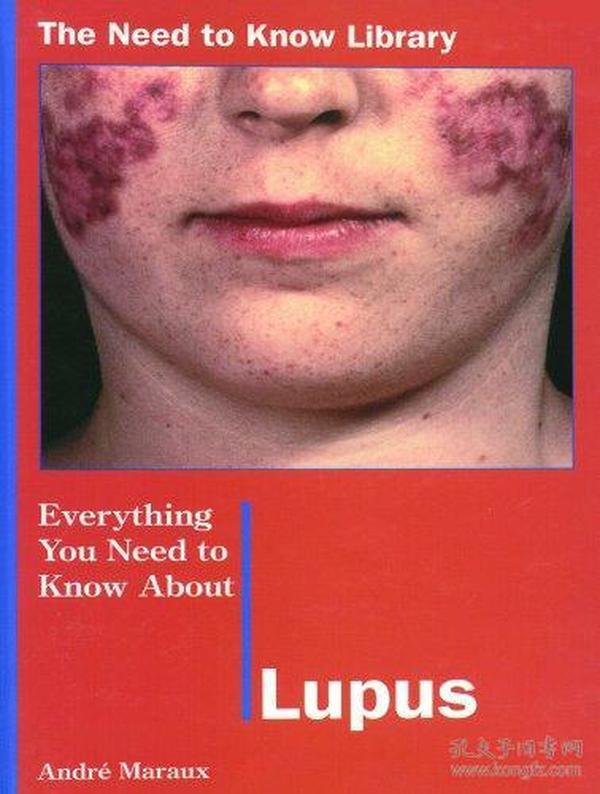 Everything Yntka Lupus (The Need to Know Library)