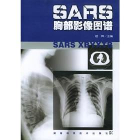 SARS胸部影像图谱