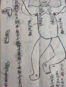 【提供资料信息服务】B6151 《跌打部》落款“奸者莫教，少傅为高”能福顺记书中记除了常见的36大穴救治法外，还详细记载72小穴之救治方法，更有价值的是打穴手法讲得很详尽连用的手型也绘出图来（其它书很少讲到或只简单说下手型）解穴推拿图正背两幅描述的也非常细至（42筒子页）