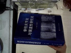 脊柱关节炎与强直性脊柱炎 (作者签名本)