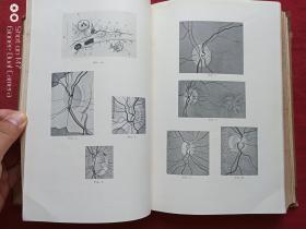 南满铁路大连医院馆藏英国眼科学杂志1929年第13期（the british journal of ophthalmology 13 1929）