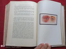 南满铁路大连医院馆藏英国眼科学杂志1929年第13期（the british journal of ophthalmology 13 1929）