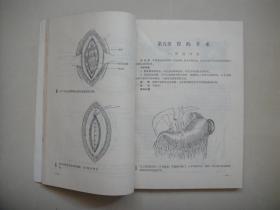 腹部外科手术图解 人民卫生出版社（56年1版72年3版12印）