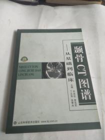 颞骨CT图谱---从基础到临床】12
