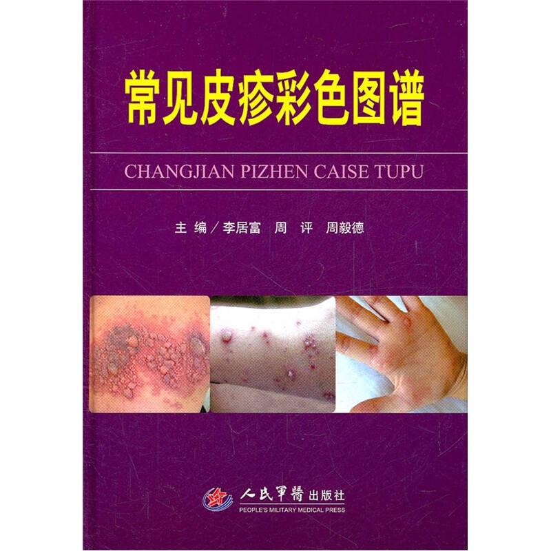 常見皮疹彩色圖譜