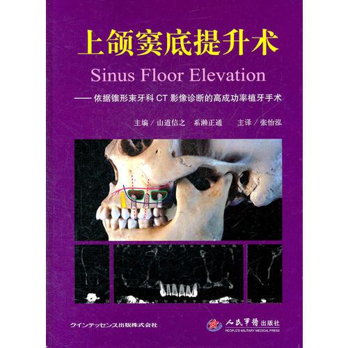 上颌窦底提升术 精装