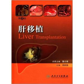 肝移植（第2版）