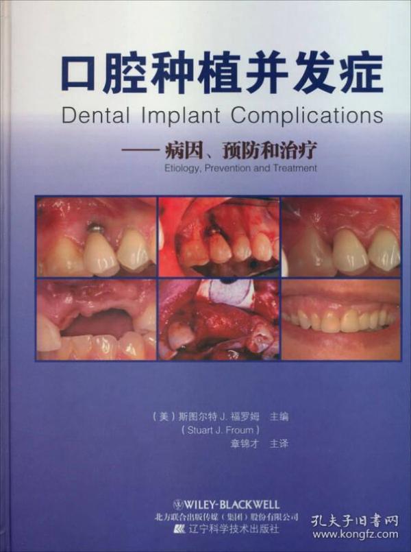 口腔种植并发症：病因预防和治疗