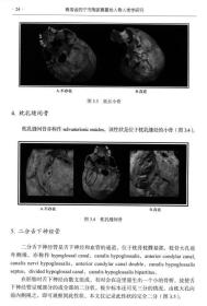 青海省西宁市陶家寨墓地人骨人类学研究