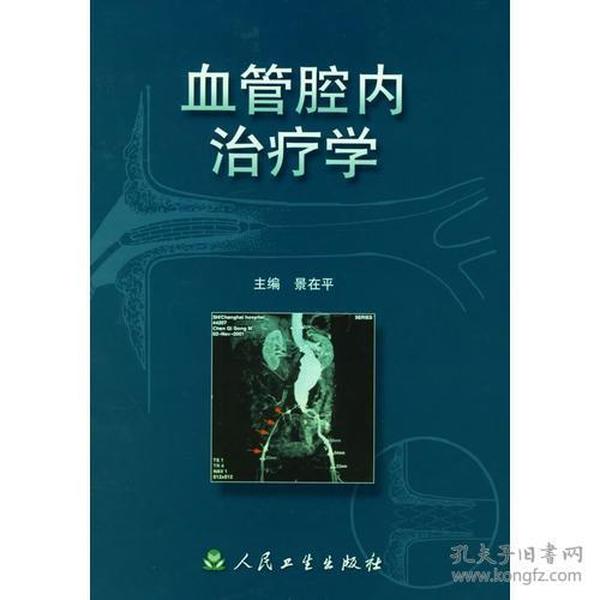 血管腔内治疗学