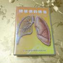 结核病的防治VCD 解放军卫生音像出版社 ISBN 9787880534115