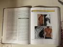 Surgical Management of Spinal Deformities 脊柱畸形手术治疗