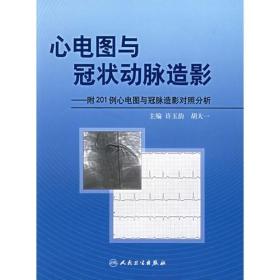 心电图与冠状动脉造影：附201例心电图与冠脉造影对照分析（近全新未阅）