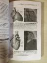 Introductory Guide to Cardiac Catheterization 心导管插入手术指南