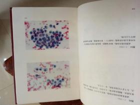 阴道细胞学图谱（1973一版一印硬精装）