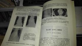 先天性心脏病临床放射学  【1994年 一版一印  原版书籍】 作者 : 胡为民主编 出版社 : 人民卫生出版社