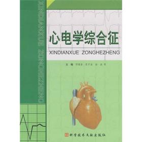 心电学综合症