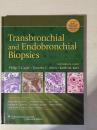 Transbronchial and Endobronchial Biopsies 经支气管和支气管活检