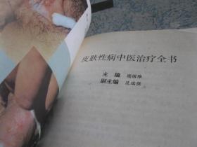 皮肤性病中医治疗全书