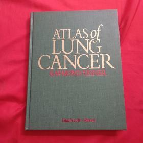 Atlas of Lung Cancer :department of pathology yale university school of medicine new haven