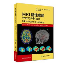 MRI阴性癫痫:评估与外科治疗18308
