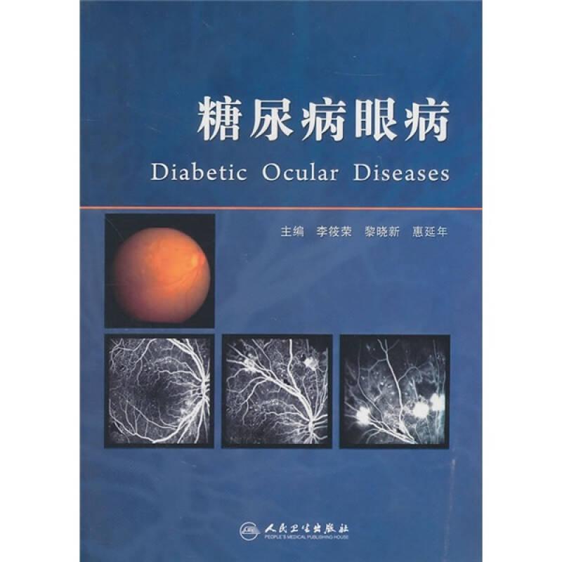 糖尿病眼病