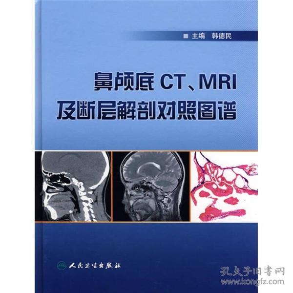 鼻颅底CT、MRI及断层解剖对照图谱