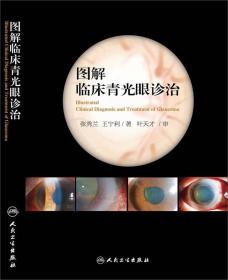 图解临床青光眼诊治
