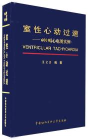 室性心动过速：600幅心电图实例