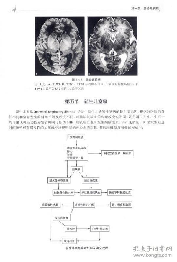 颅脑MRI诊断与鉴别诊断（第2版）