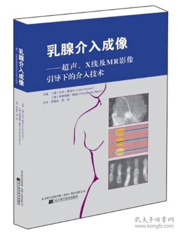 乳腺介入成像：超声、X线及MR影像引导下的介入技术